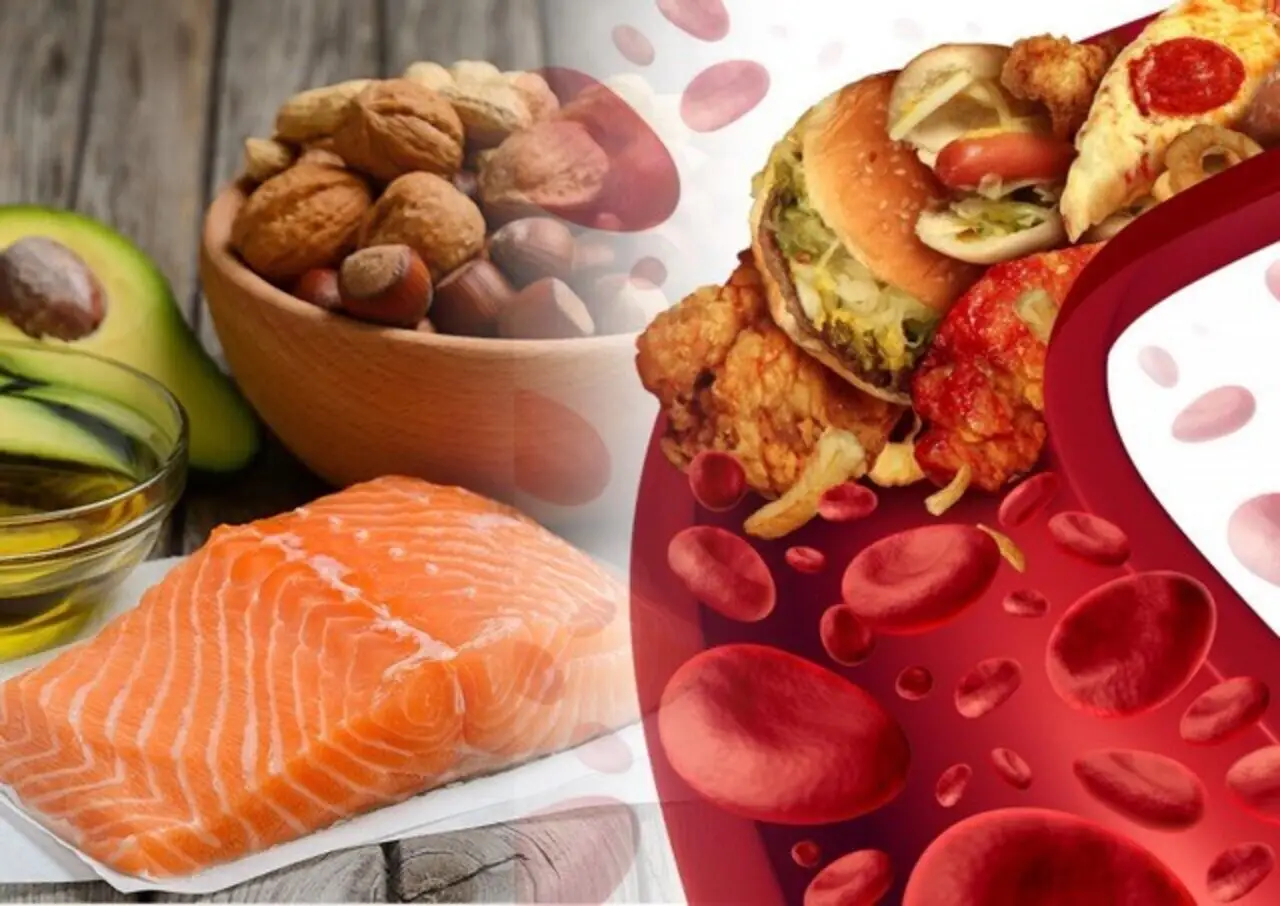 Colesterolo alto: quali cibi eliminare dalla dieta secondo il cardiologo Colesterolo alto: quali cibi eliminare dalla dieta secondo il cardiologo